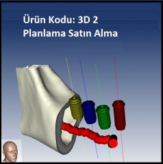 3D Planlama Satın Alma Tek Çene ( Fiyat öğrenmek için lütfen üyelik girişi yapınız )